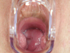 Caliente chica de piernas largas Promesita en uniforme se pone traviesa. Petite babe lleva uniforme de enfermera, medias y tacones altos. Ella dedos y coño abre su agujero de orina en gyno silla en gyno clinic.
